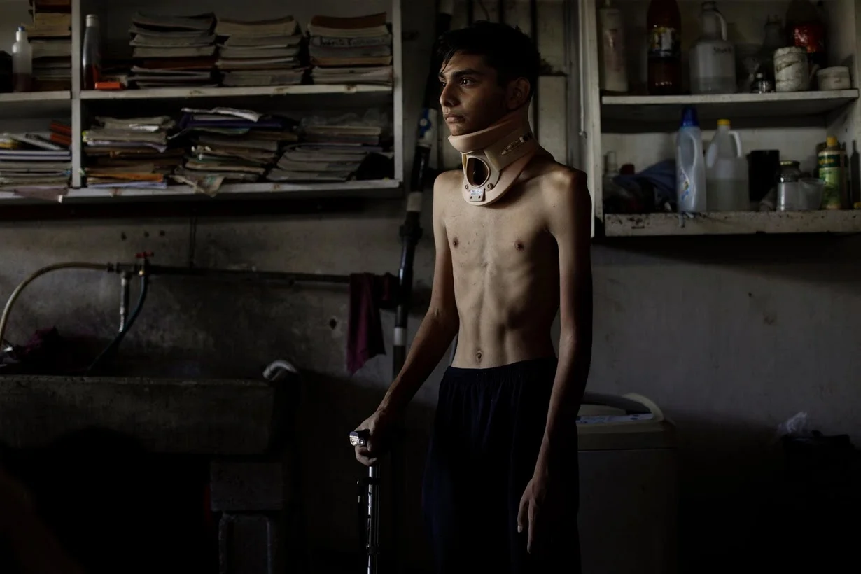Jofre Rodriguez, 18, sufrio fractura de quijada por impacto de bala el 26 de junio / Foto: Reuters