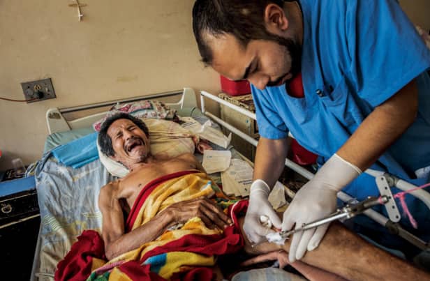 Ante la falta de material, los médicos tiran de inventiva. El doctor Navas inmoviliza la pierna con un armazón casero hecho con tubos y cuerdas. El médico cuenta que perforó una tibia con una taladradora que le prestaron en una tienda de bricolaje