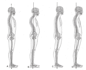 The Body Will Find a Way