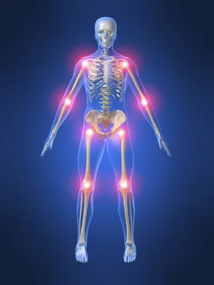 When Acute Injury Leads to Chronic Pain