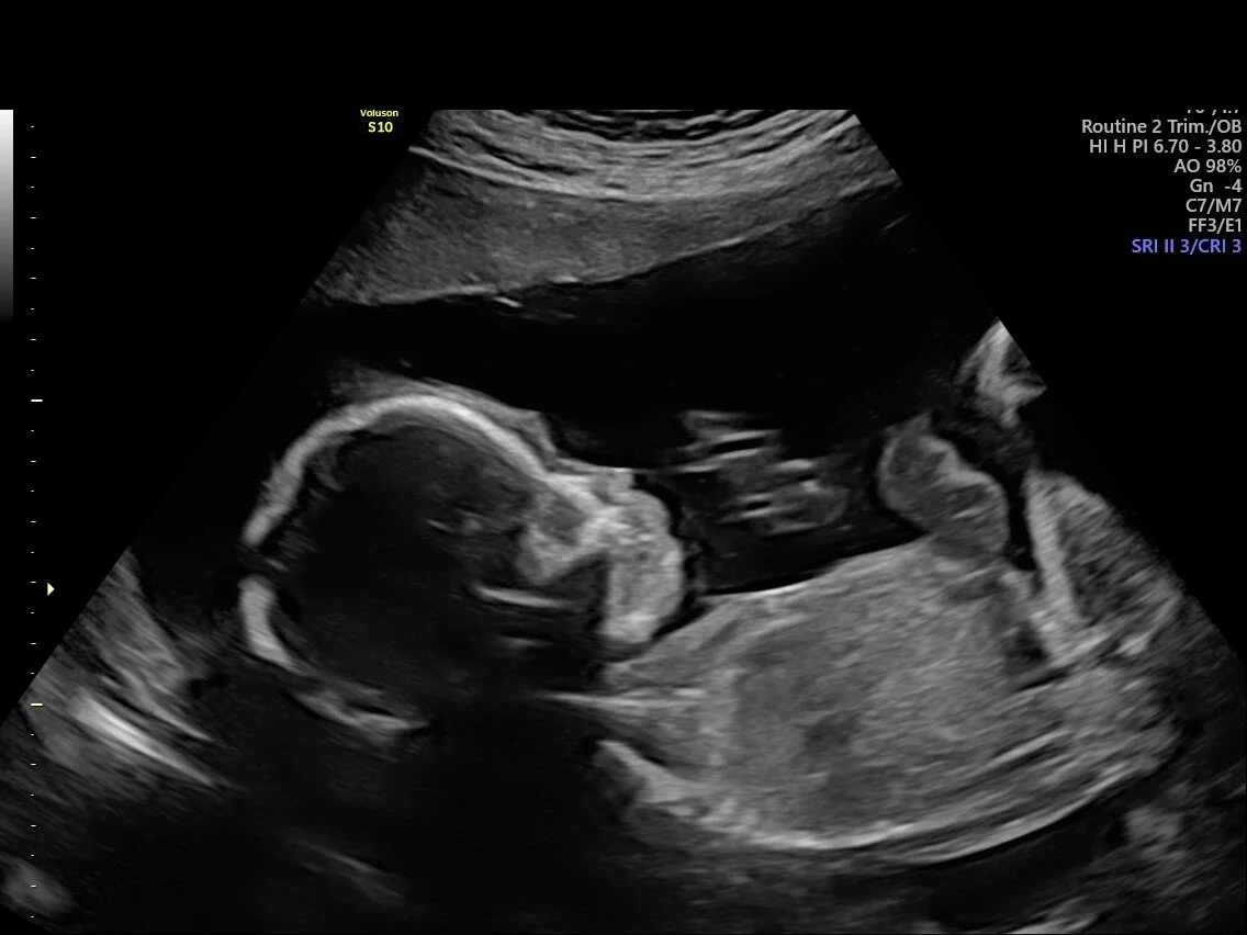 What is it like being pregnant?