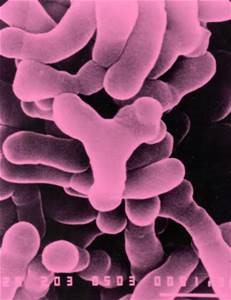 Figure 3: Gram-positive Bifidobacteria