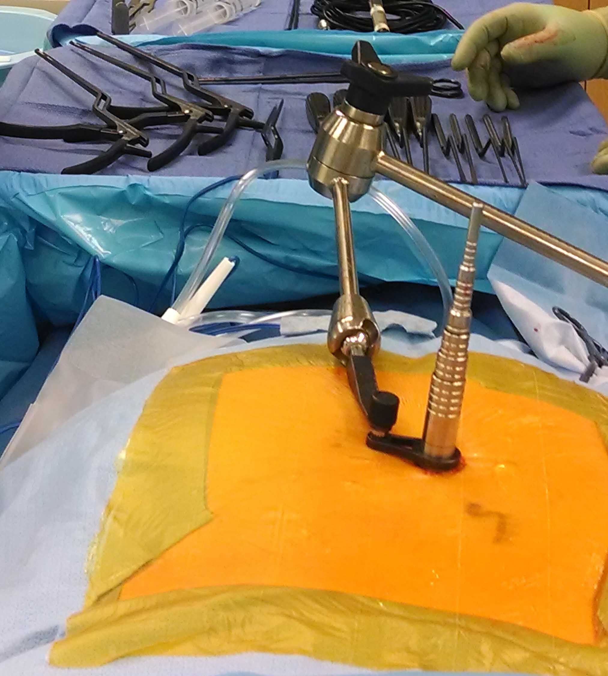 dilating tubes 2.jpg