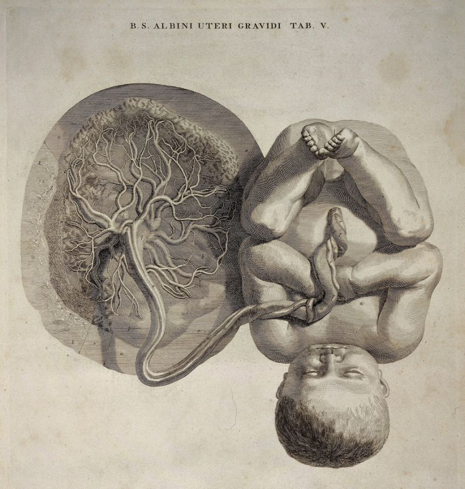 Foetus attached to the umbilical cord and placenta (Wellcome Library).