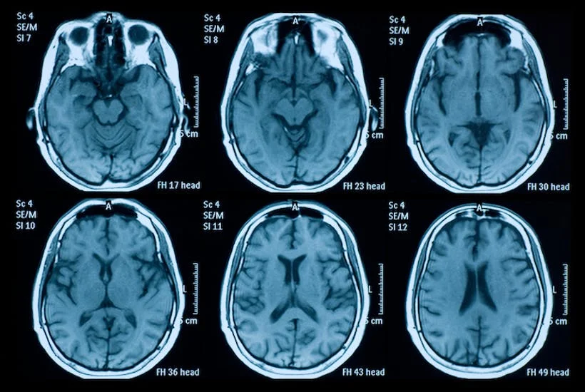 mri.jpg