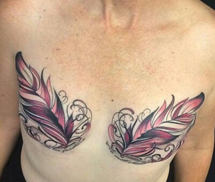 mastectomy1.jpg