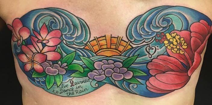 mastectomy2.jpg