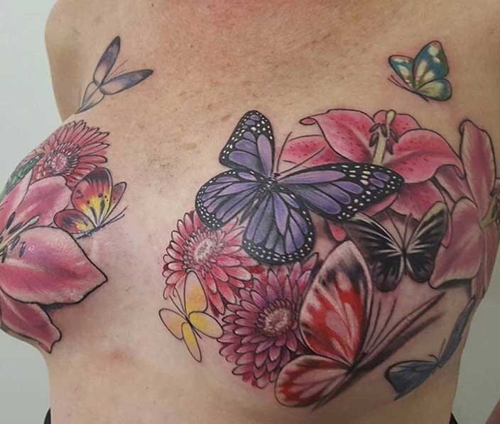 mastectomy3.jpg