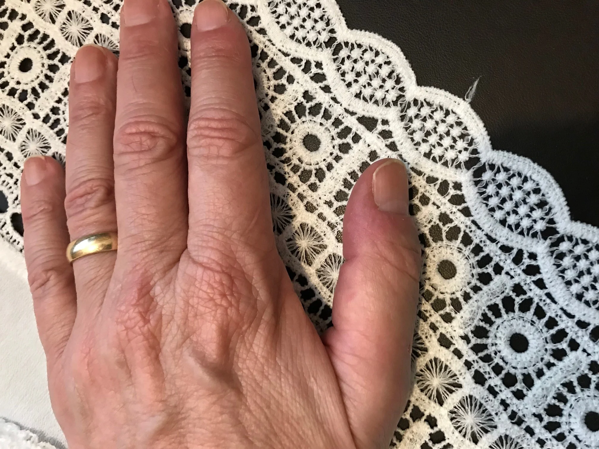 Rings and Frilly Things: A Guy's Perspective