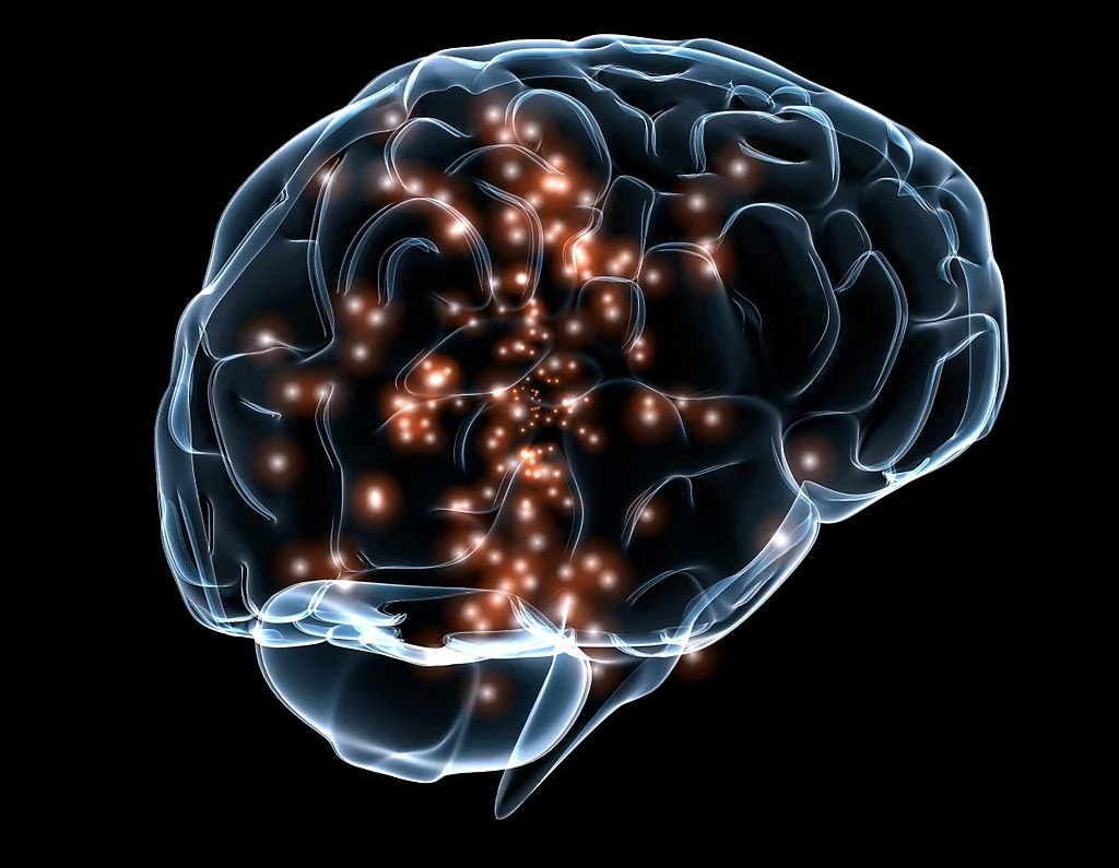I Dreamed I Had a Stroke