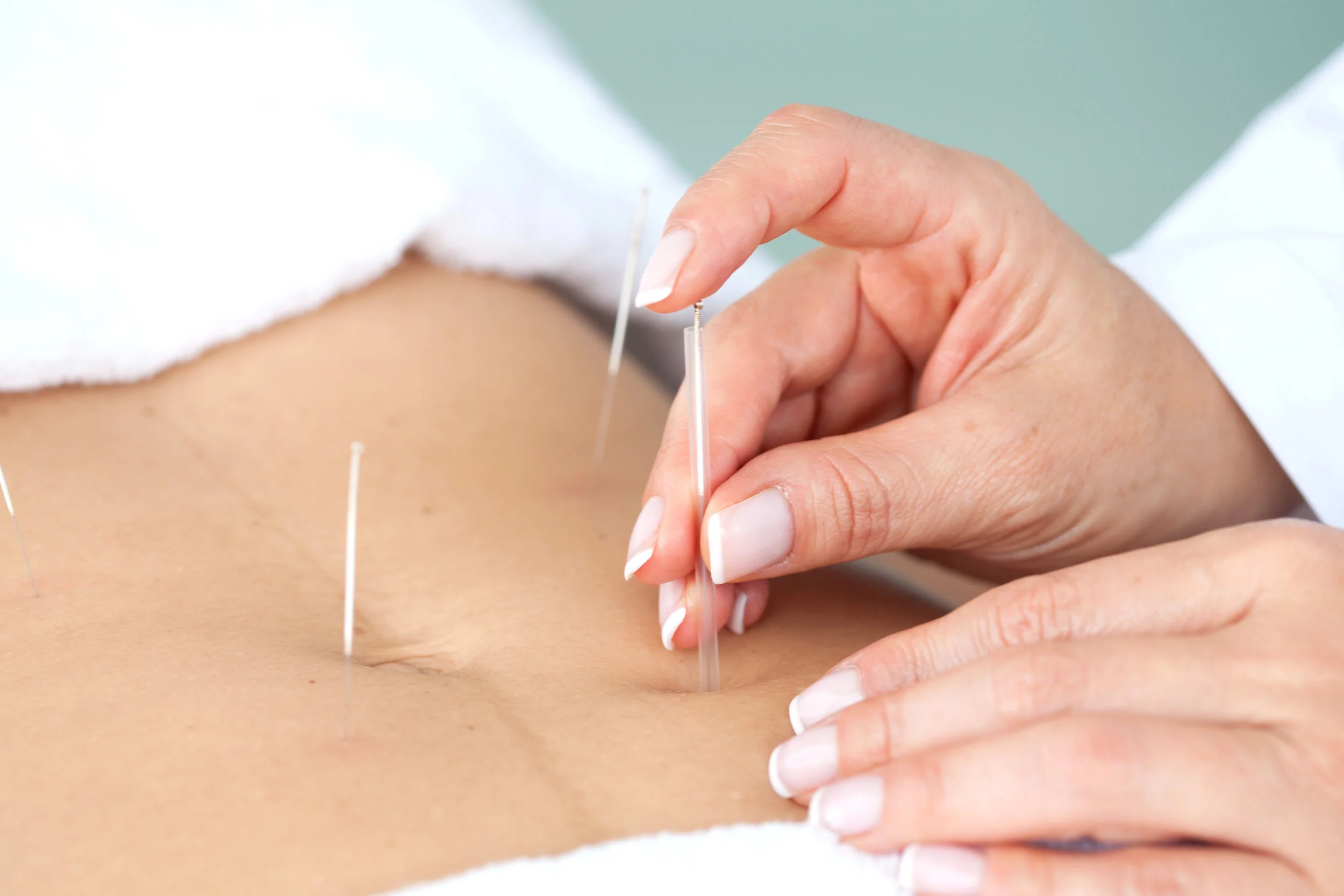 The Skinny On Acupuncture For Fertility