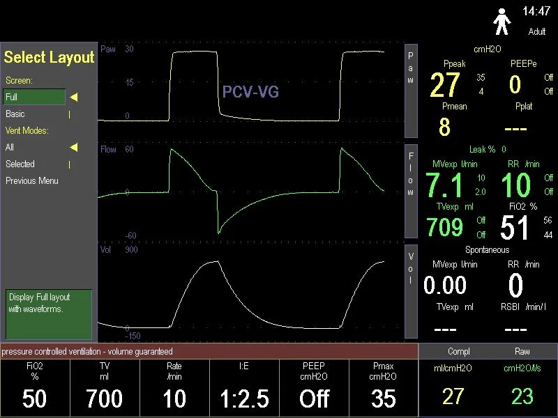 BEFORE: Original Engstrom Ventilator User Interface (click to enlarge)