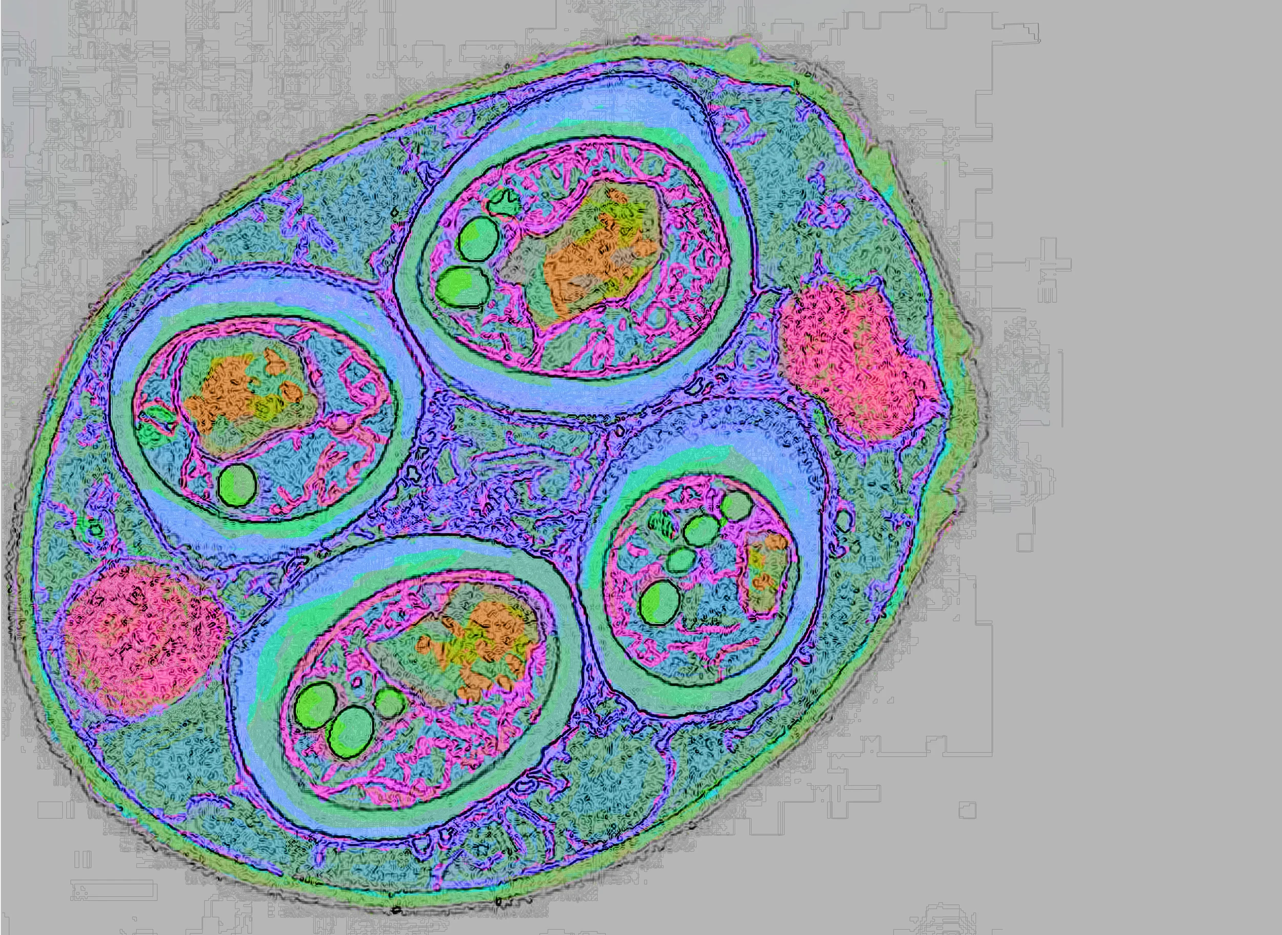 test2bluecolor10findedge2clean9M9372-TEM-of-Saccharomyces-Cerevisiae-1 copy.jpg
