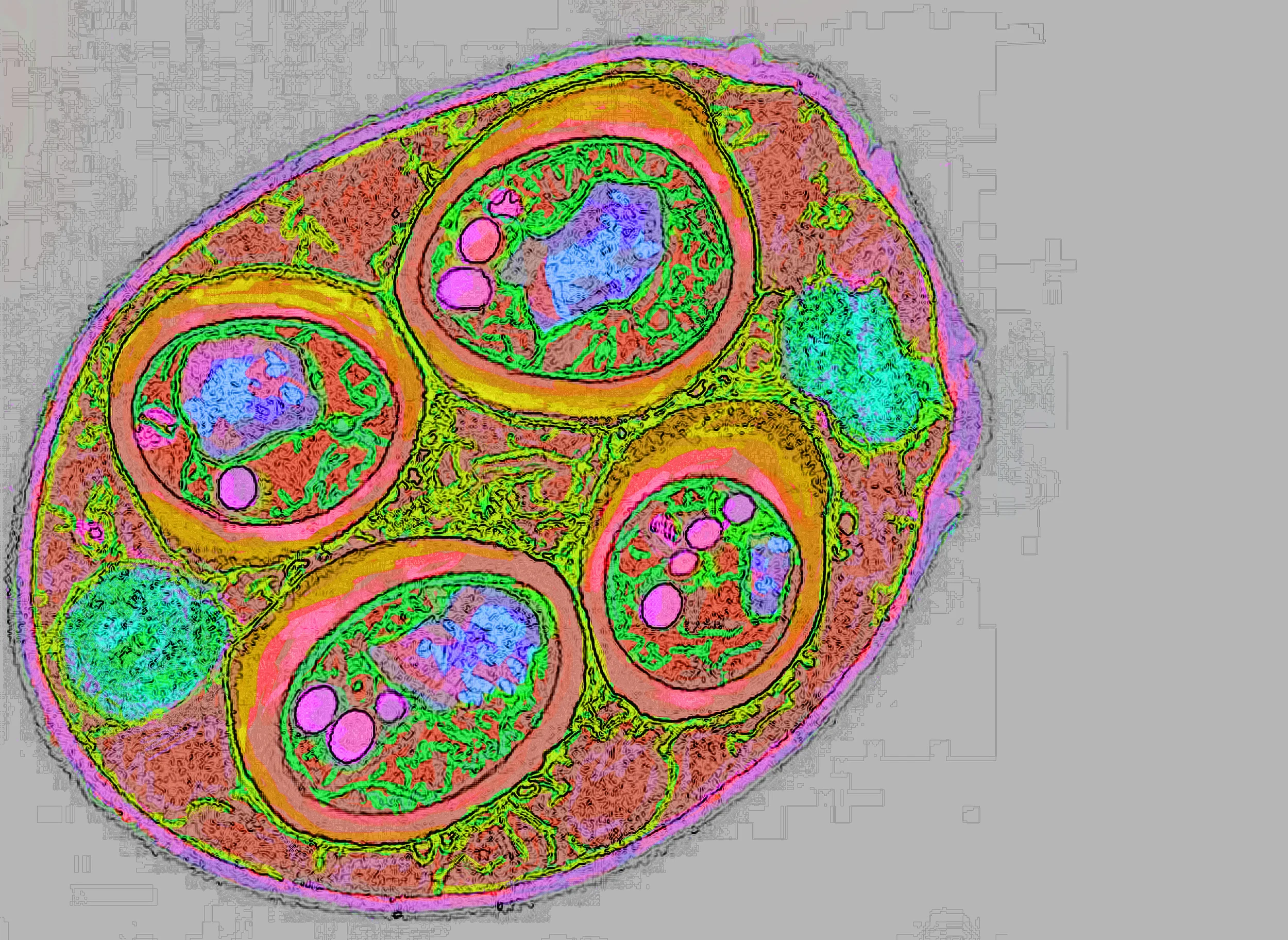 test3lightorangecolor10findedge2clean9M9372-TEM-of-Saccharomyces-Cerevisiae-1 copy-Recovered.jpg