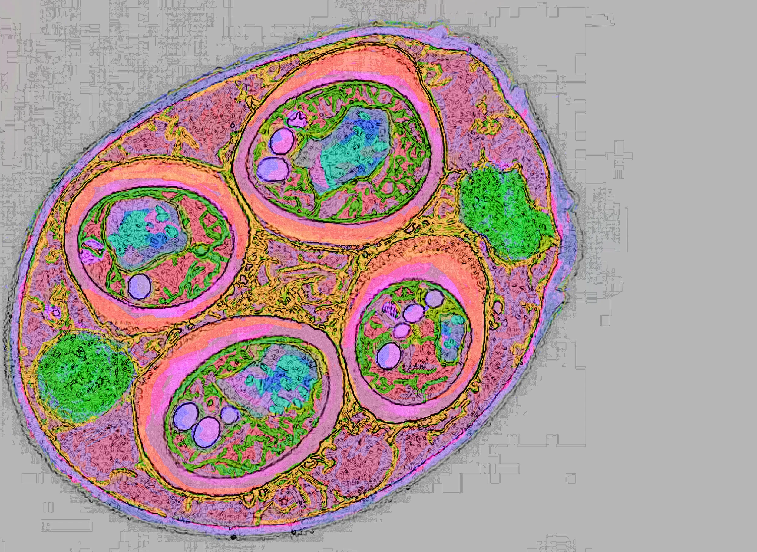 test3lightorangecolor10findedge2clean9M9372-TEM-of-Saccharomyces-Cerevisiae-1 copy-Recovered.jpg