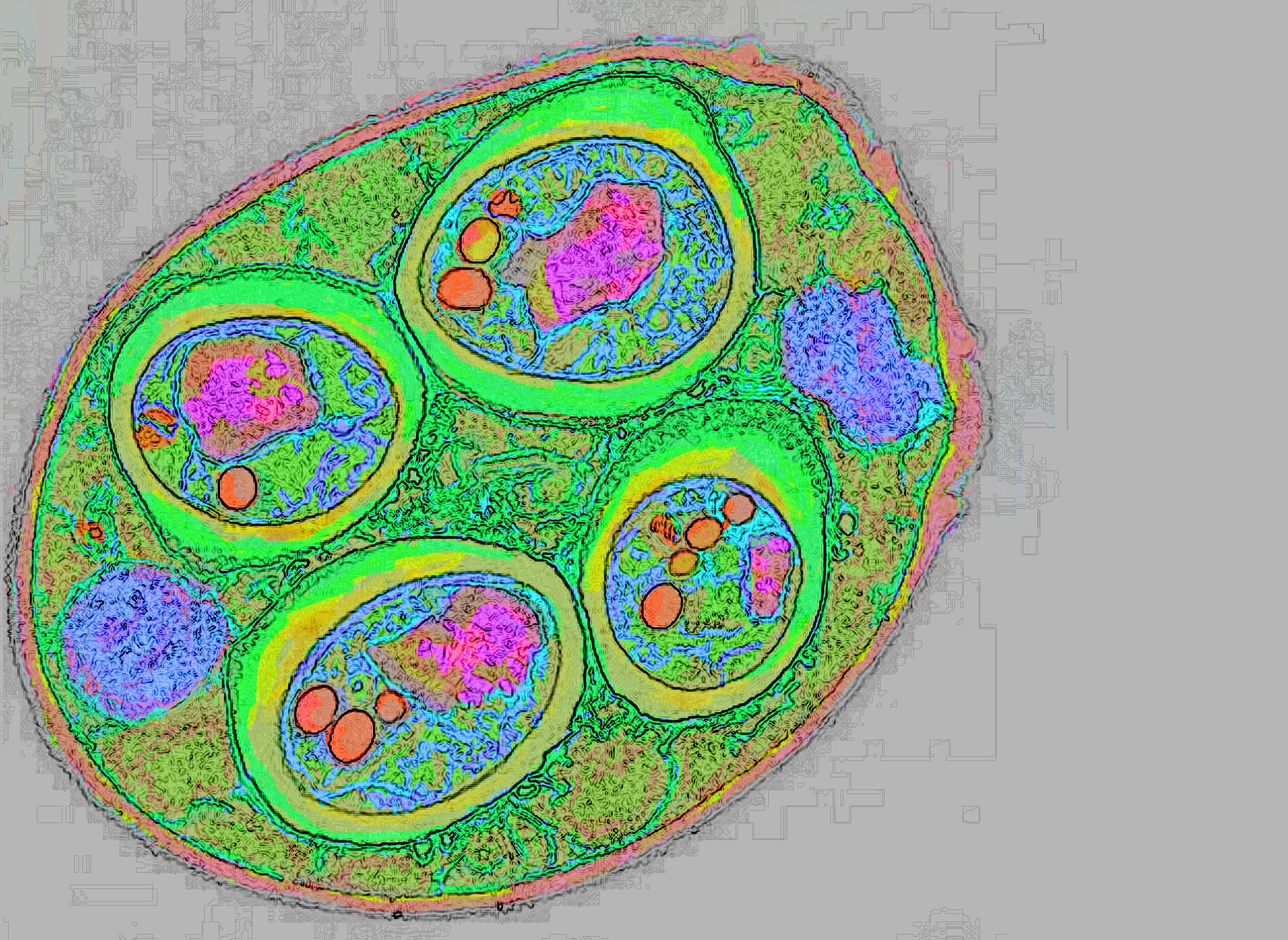 test3greencolor10findedge2clean9M9372-TEM-of-Saccharomyces-Cerevisiae-1 copy-Recovered.jpg