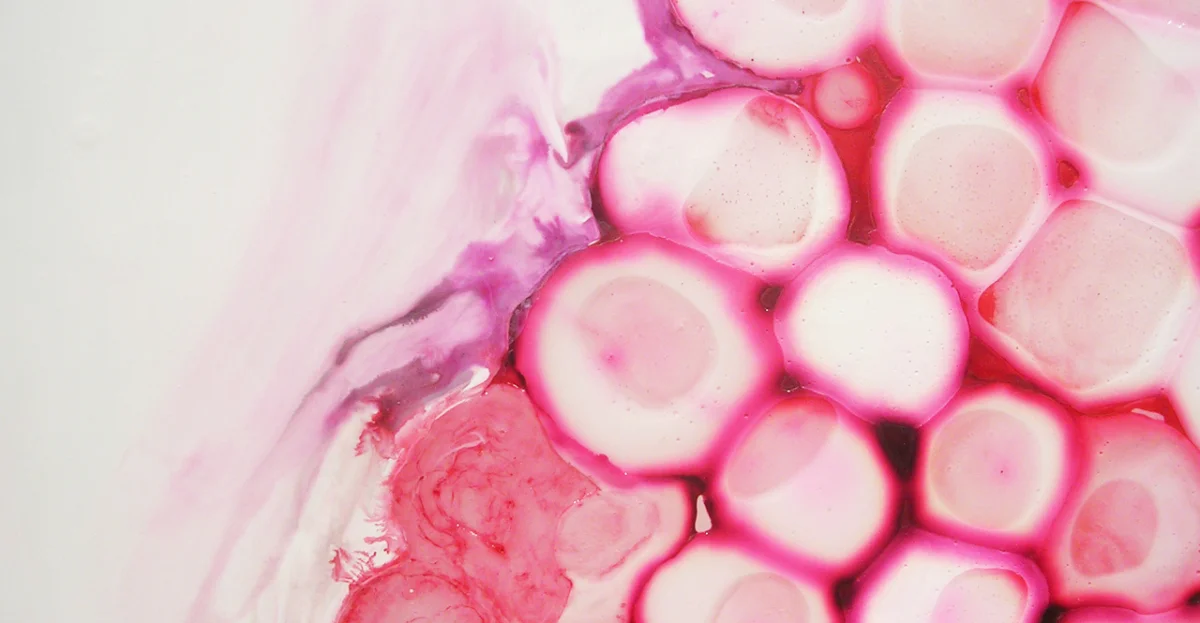 Bubble n Drawl, detail 2011 ink and acrylic on mylar 163 by 212 inches 