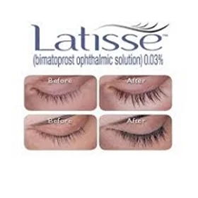 Latisse3.jpg