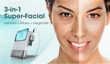 oxygeneo2.jpg