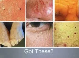 SkinClassic.jpg