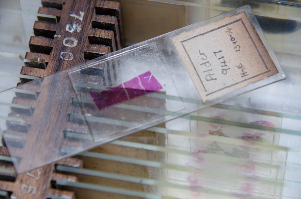 Urbex: West Park Moruary and Histopathology
