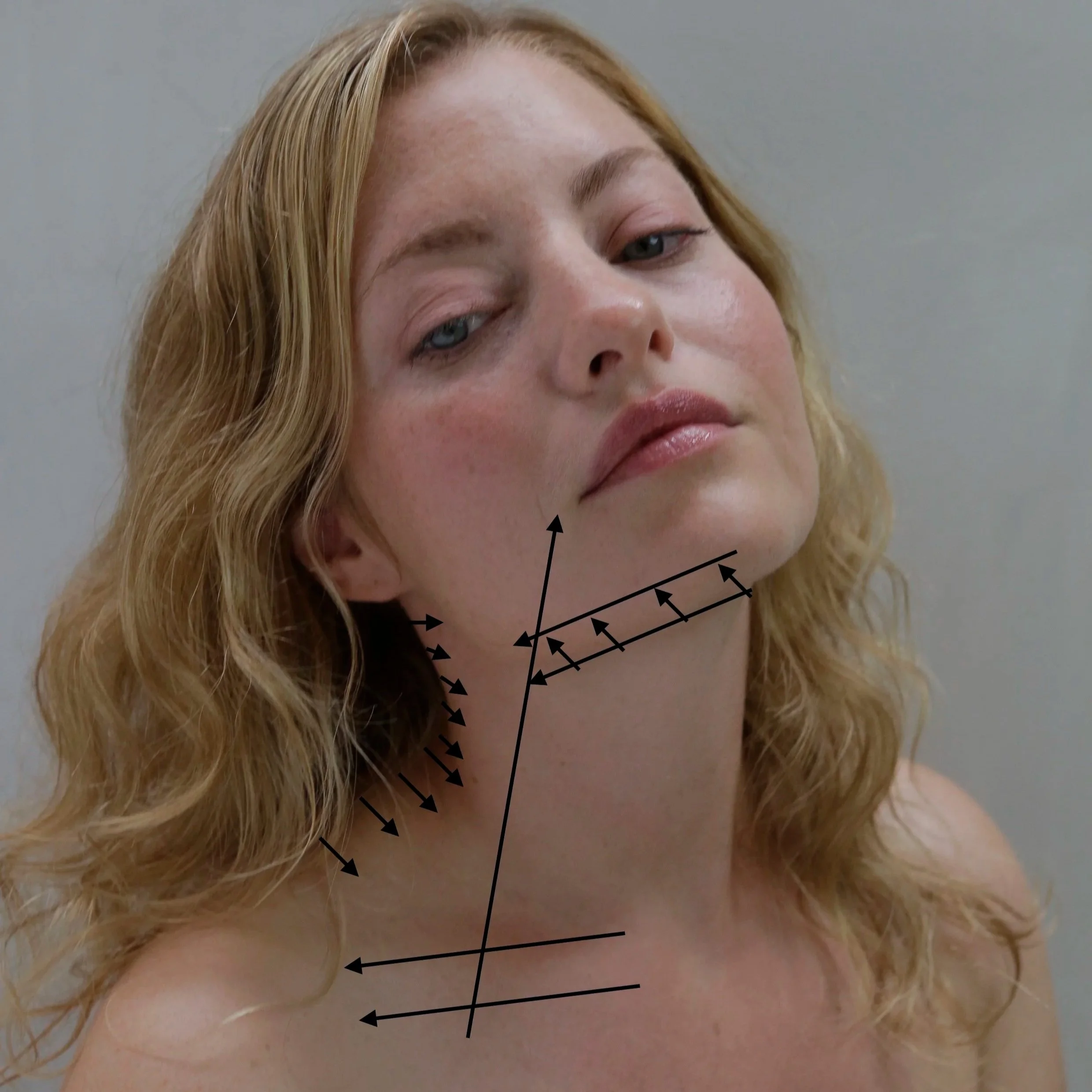 Kulde får bindevævet til at gå i vinterhi