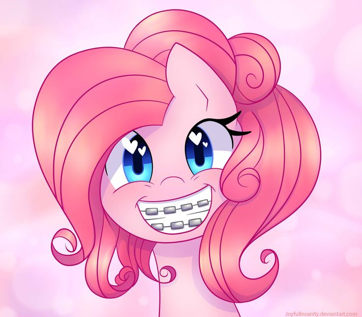Pinkie Pie from My Little Pony Has Braces