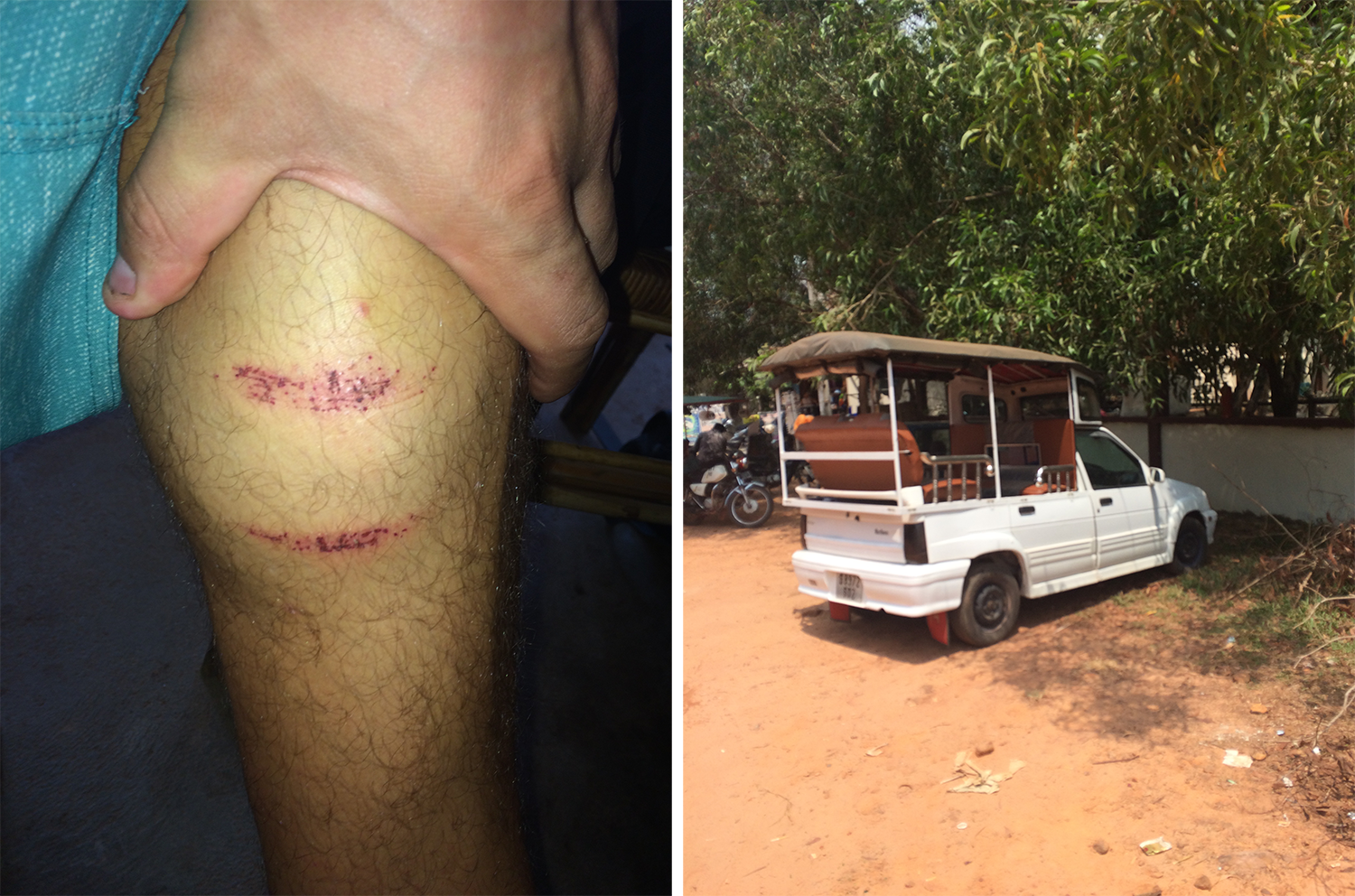 Left: Mikey's scratch from getting kicked by the cow. Right: One of the best tuk tuk ideas of the whole trip in Otres Beach! 