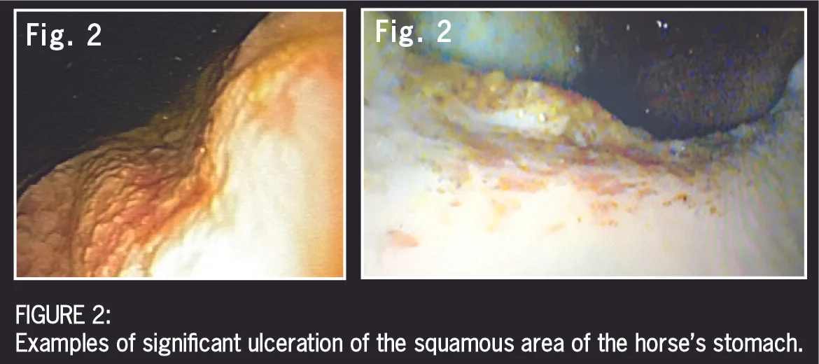 Ulcer Fig 2-04.jpg