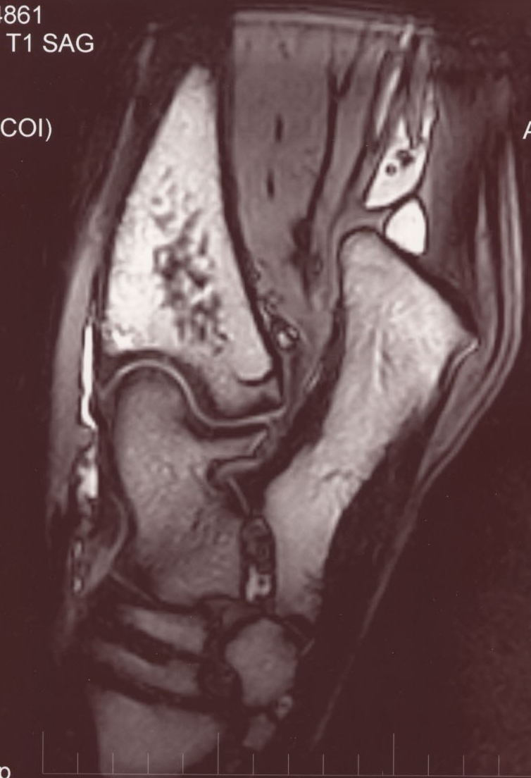 Hock MRI.jpg
