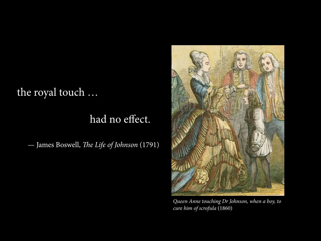 “The royal touch … had no effect.”