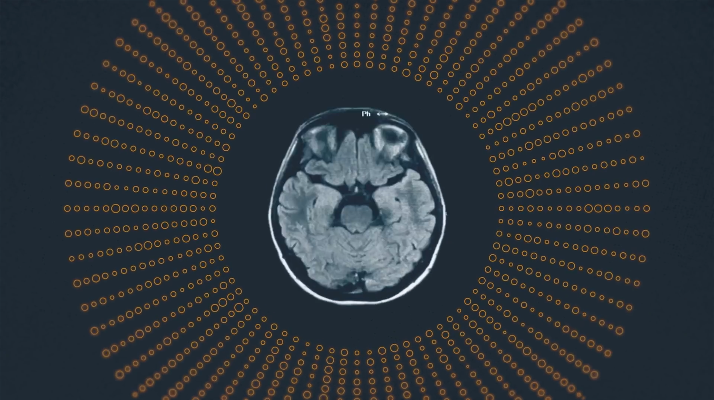 Inside Your Mind with Stephen Fry