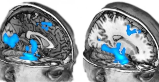 Study reveals how ecstasy acts on brain, hints at therapeutic uses