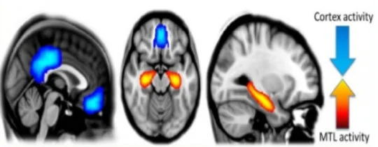 Biological basis for magic mushroom 'mind expansion' discovered