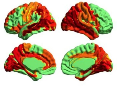 Evidence of a 'higher' state of consciousness?