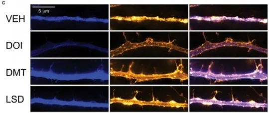 Psychedelic drugs promote neural plasticity in rats and flies