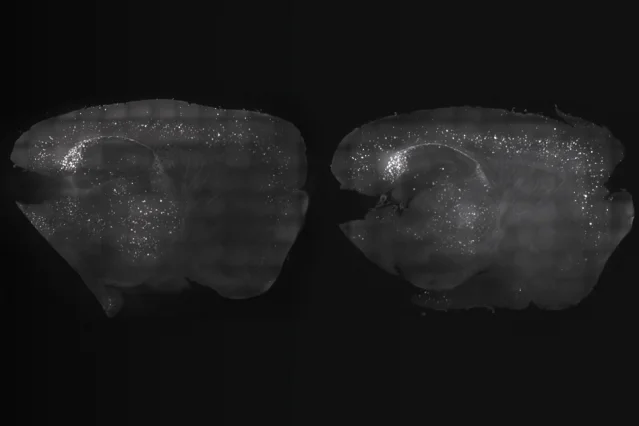 By exposing mice to a unique combination of light and sound, MIT neuroscientists have shown that they can improve cognitive and memory impairments similar to those seen in Alzheimer’s patients. At left, the mouse cortex shows a reduction in amyloid plaques following visual and auditory stimulation, compared to the untreated mouse at right. Image: Gabrielle Drummond