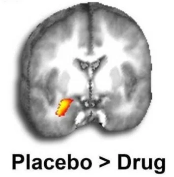  Marijuana, Genes, Medicines and Brain Scans Help Scientists Find Better Anxiety Treatments
