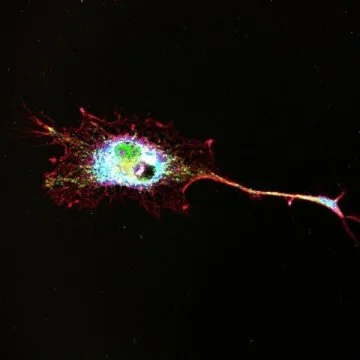 Use of non-psychoactive cannabinoids in the treatment of neurodegenerative diseases