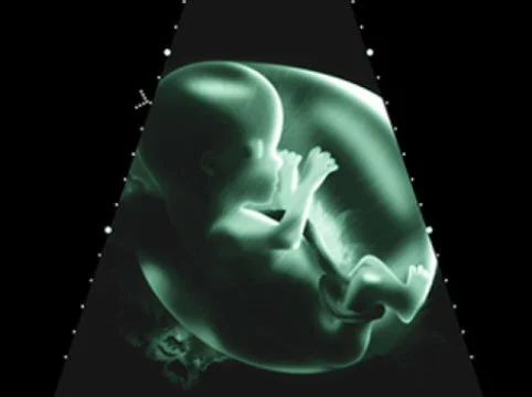 Increased levels of the body's own cannabinoids impair embryonic brain development