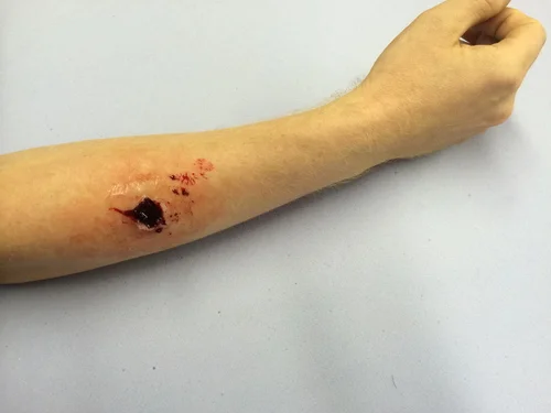 Silicone Bullet Wound