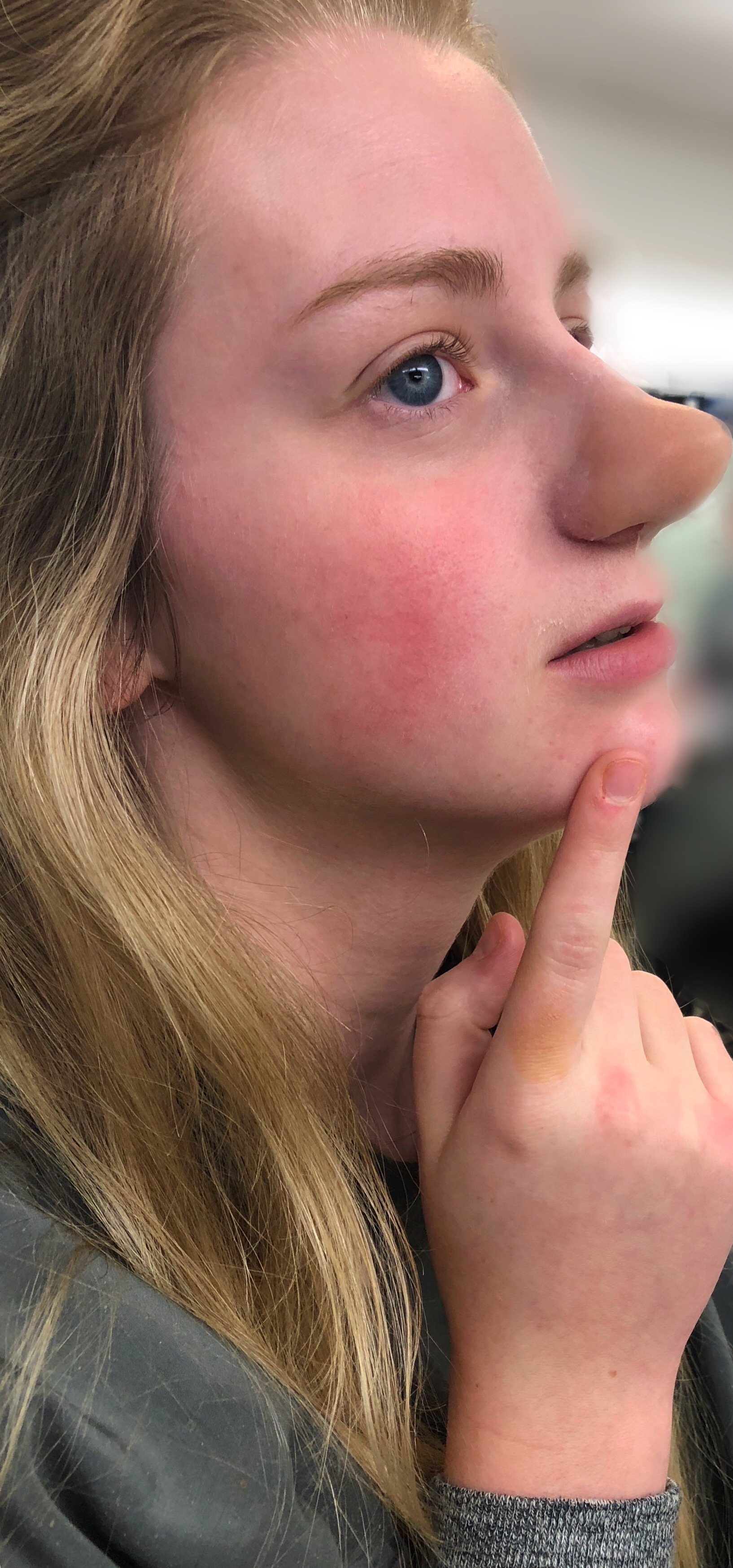Nose Prosthetic