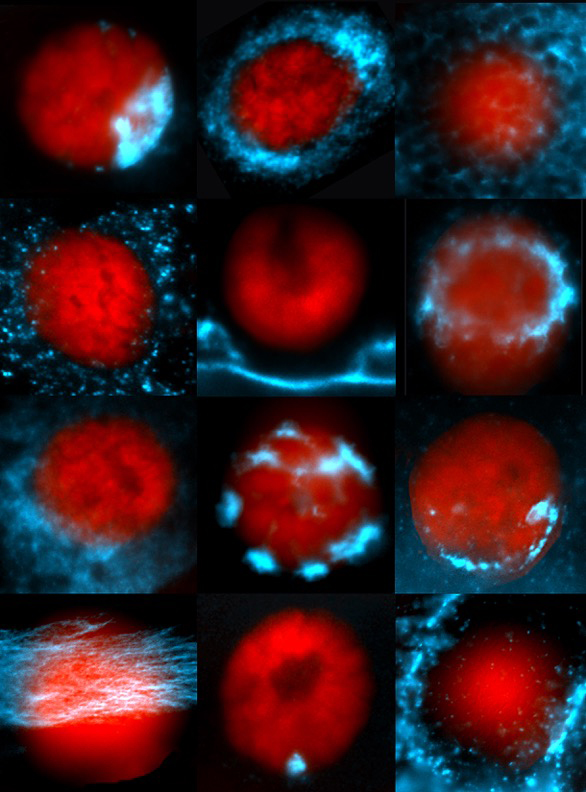 A glimpse into the breadth of RNA (in blue) distributions within cells. Nuclei are in red