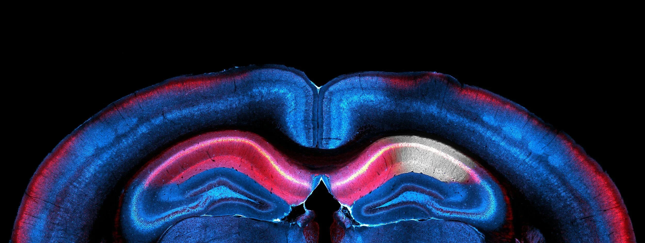 whole brain.jpg