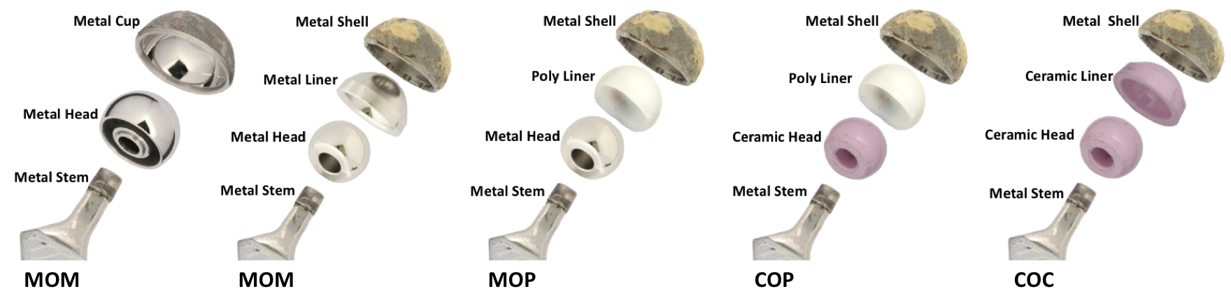 london implant retrieval centre hip replacements materials