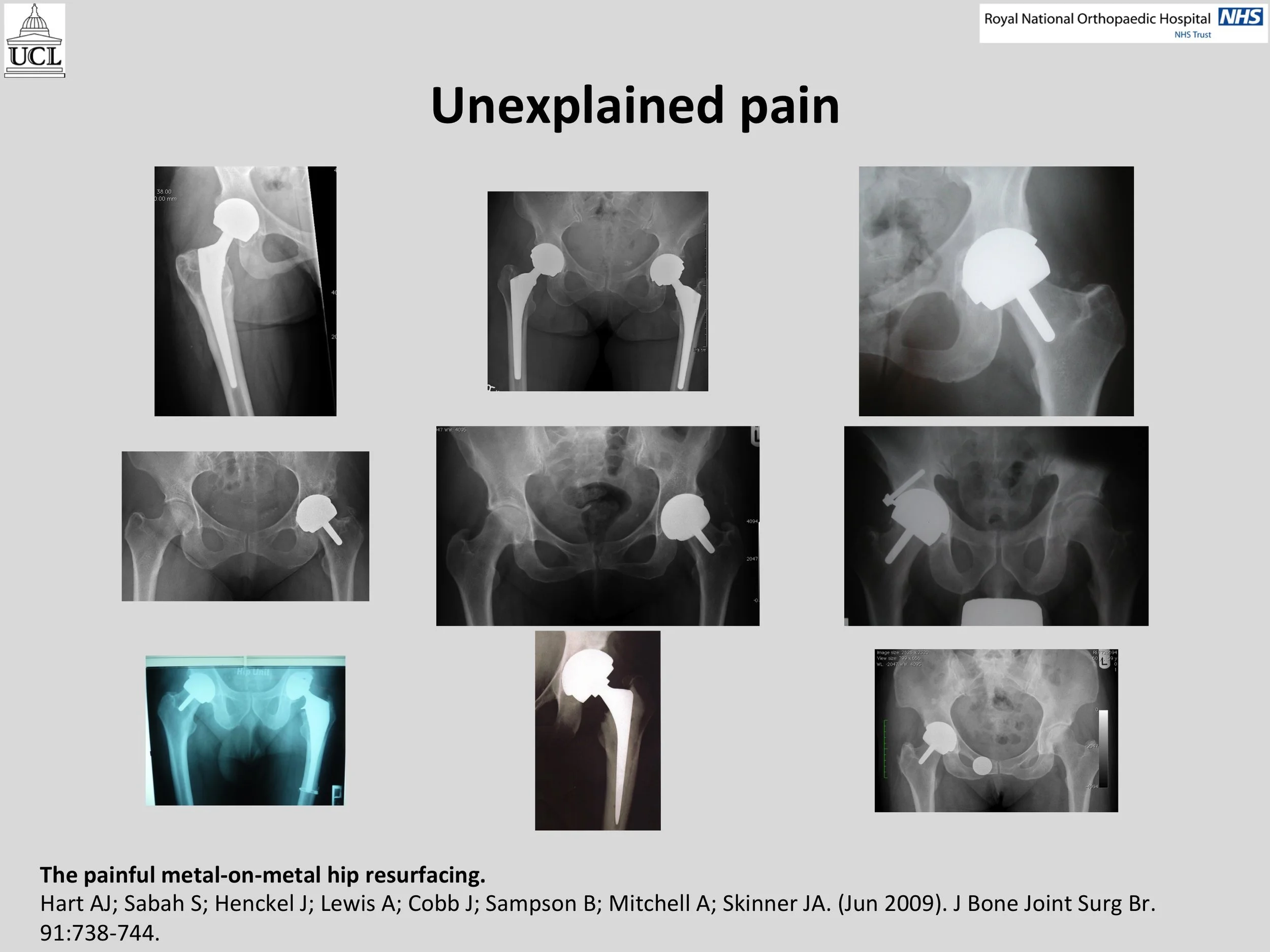 MOM Hip Info Slide06.jpg