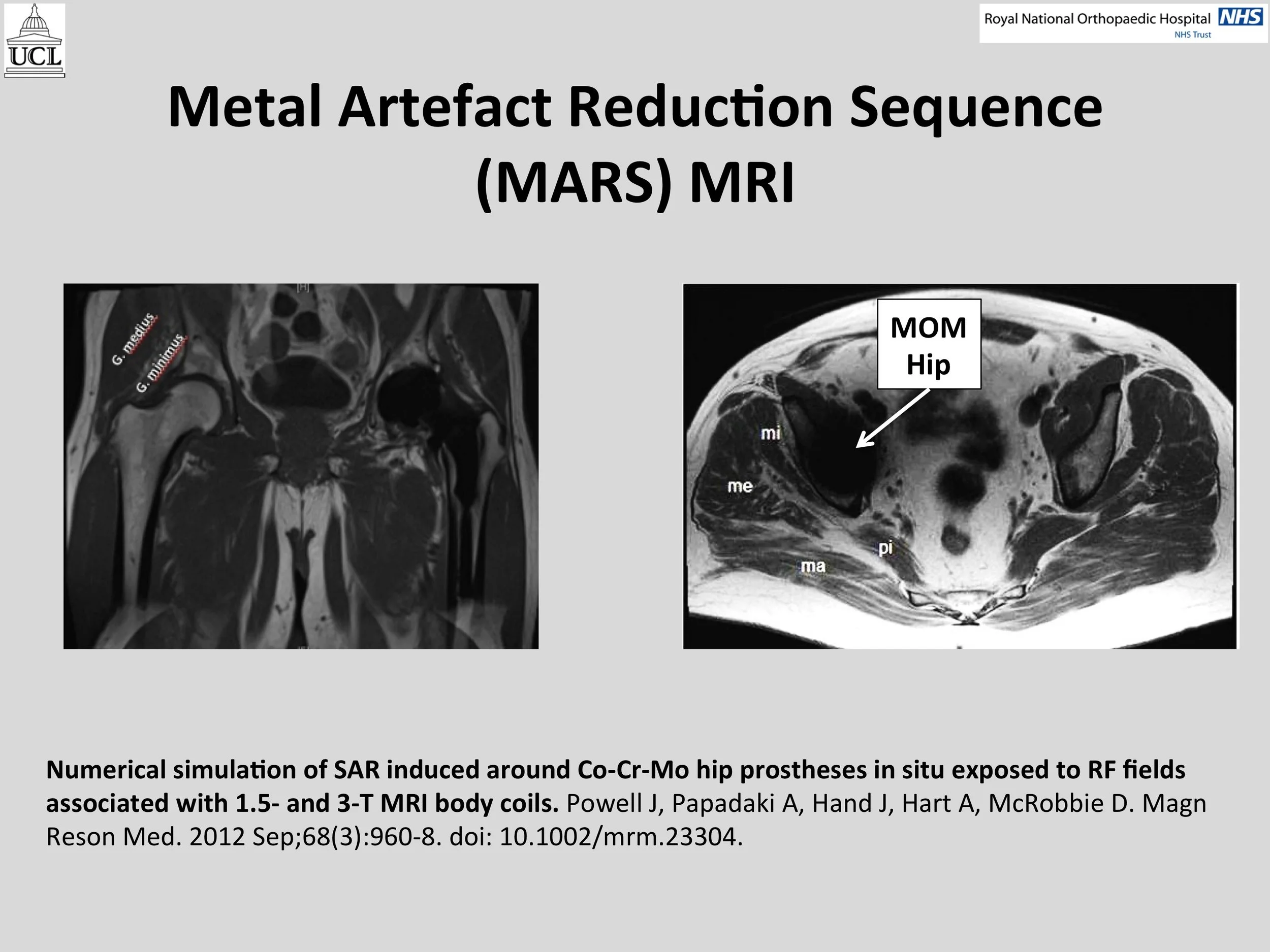 MOM Hip Info Slide10.jpg