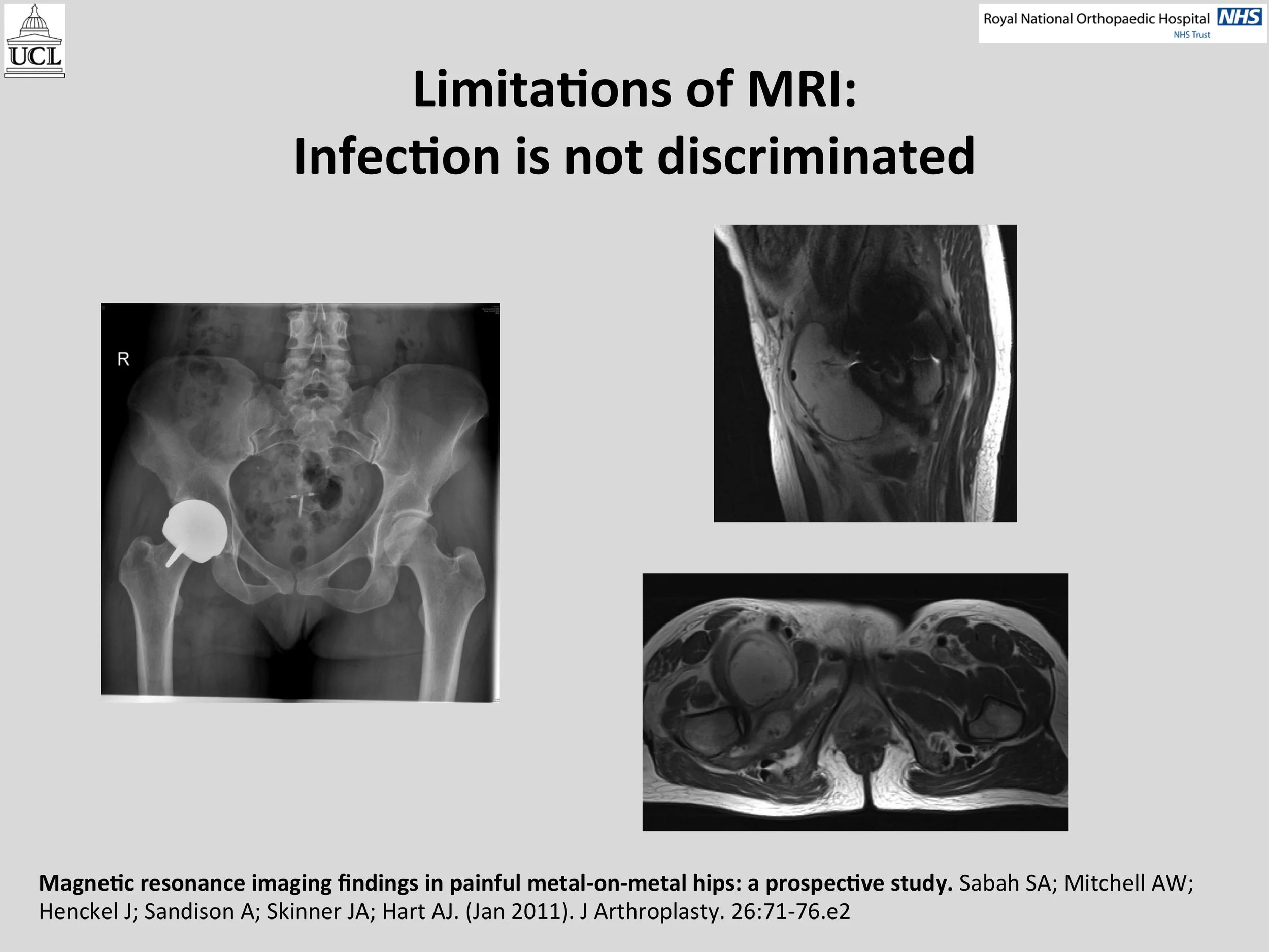 MOM Hip Info Slide15.jpg