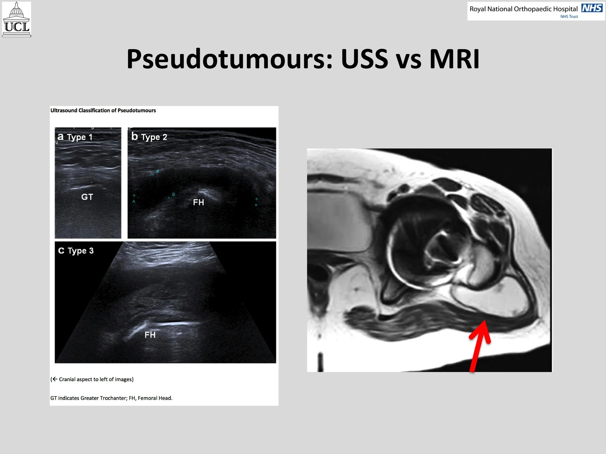 MOM Hip Info Slide20.jpg