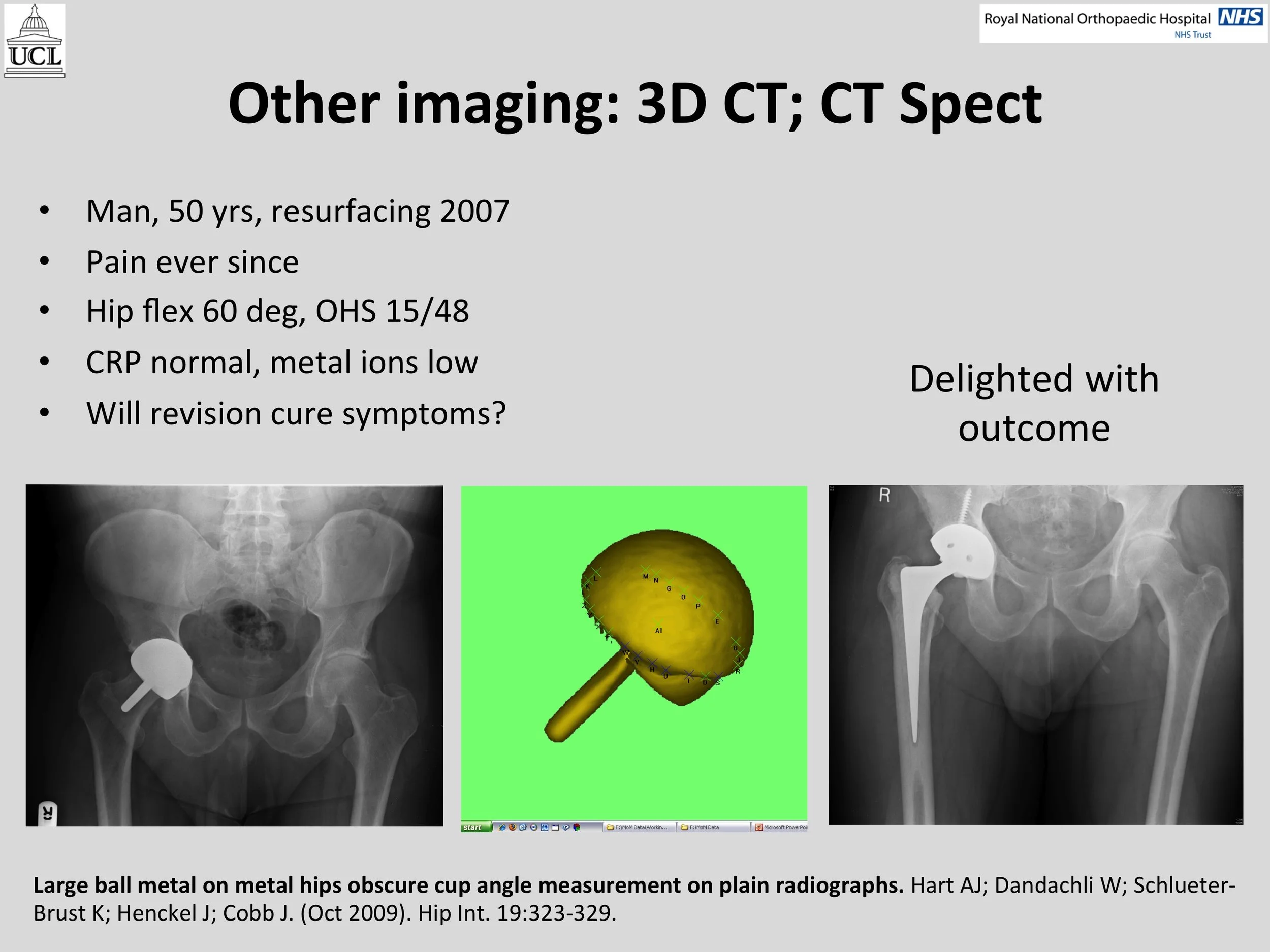 MOM Hip Info Slide22.jpg